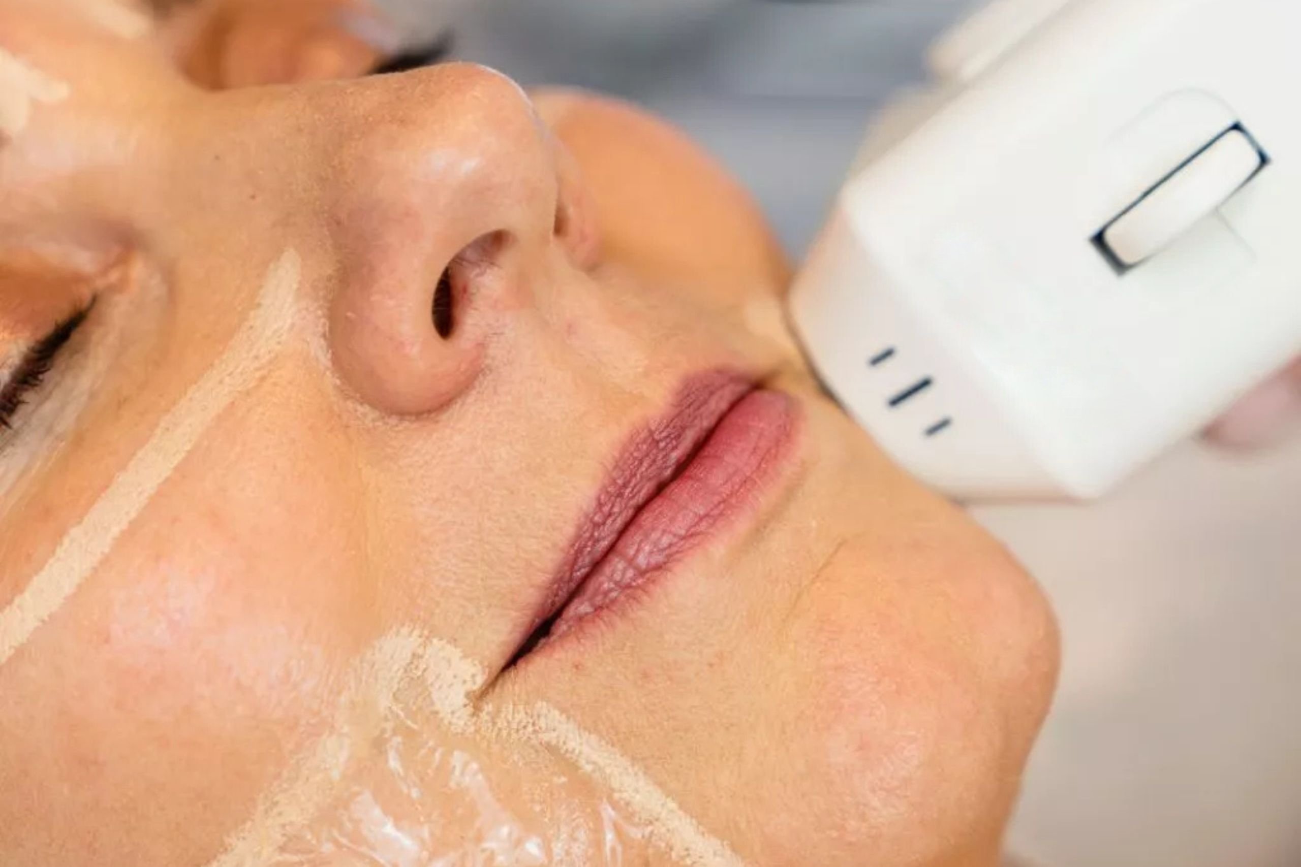 aesthetic hifu laser machine manufacturer in delhi