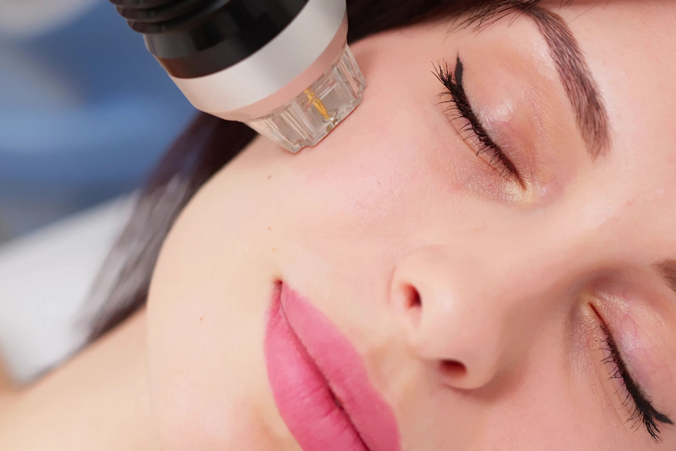 aesthetic rf laser machine manufacturer in delhi